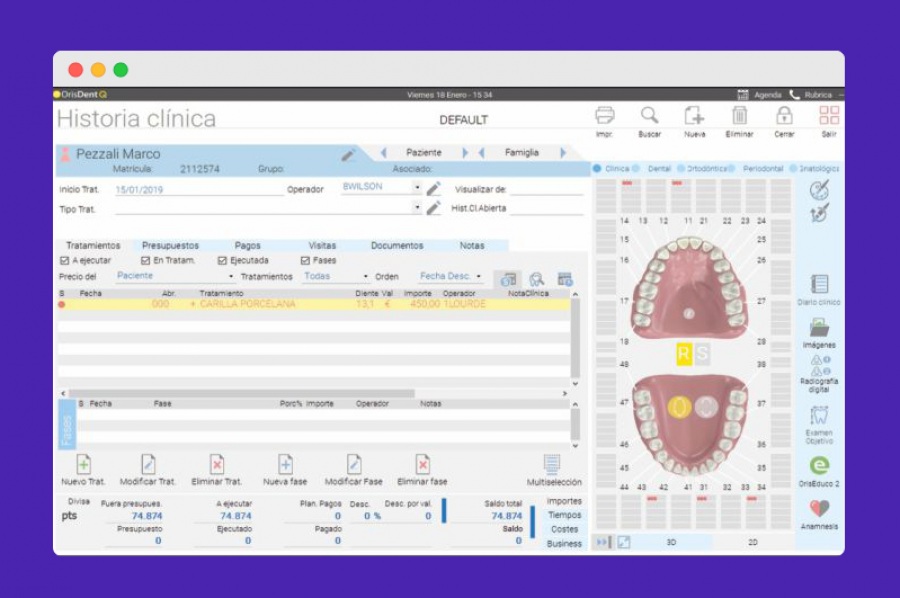 OrisLine: OrisDent Q - software para clínica dental